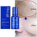 Centella Asiatica Face Serum Nourish Dry Skin Smoothing Rejuvenation Skin Brightening Whitening Cream Facial Moisturizer Korean